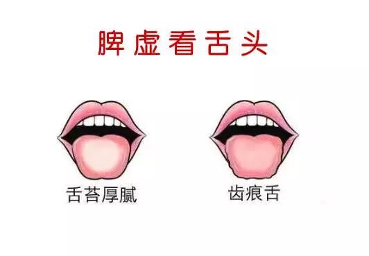 The TCM Tongue Diagnosis Atlas is Here! Observe the Tongue to Understand the Whole Body!