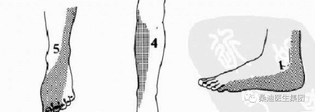 Diagnosis and Inquiry of Low Back Pain