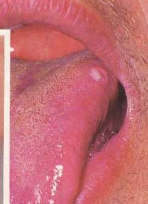 62 High-Definition Tongue Diagnosis Charts with Illustrations (Collector's Edition)