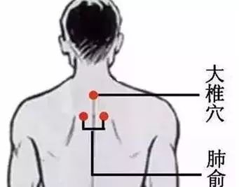 Does Excessive Gua Sha Deplete Your Energy? Self-Diagnosis Through Gua Sha for Early Health Awareness!