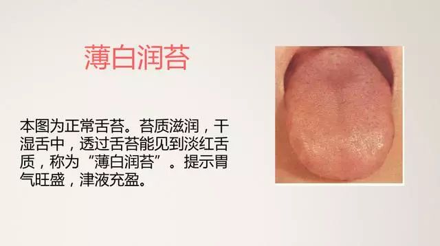 The Most Comprehensive TCM Tongue Diagnosis Atlas: Observe the Tongue, Understand the Whole Body!