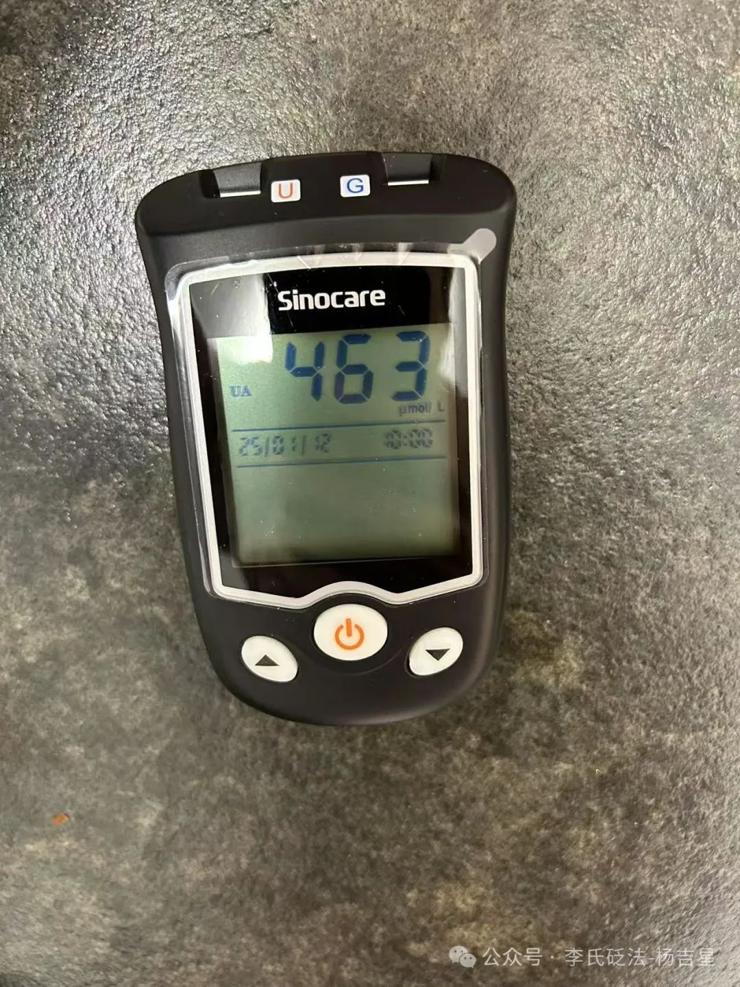 How to Use Gua Sha for Gout Management? Case Study (1)