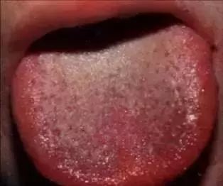 The Most Comprehensive Guide to Tongue Diagnosis! Master It and Become a Tongue Diagnosis Expert