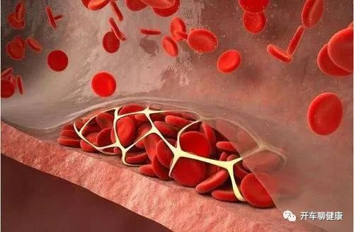 Self-Assessment of Blood Stasis Constitution: Not Only Must Blood Stasis Be Activated and Resolved, But Qi Must Also Be Nourished
