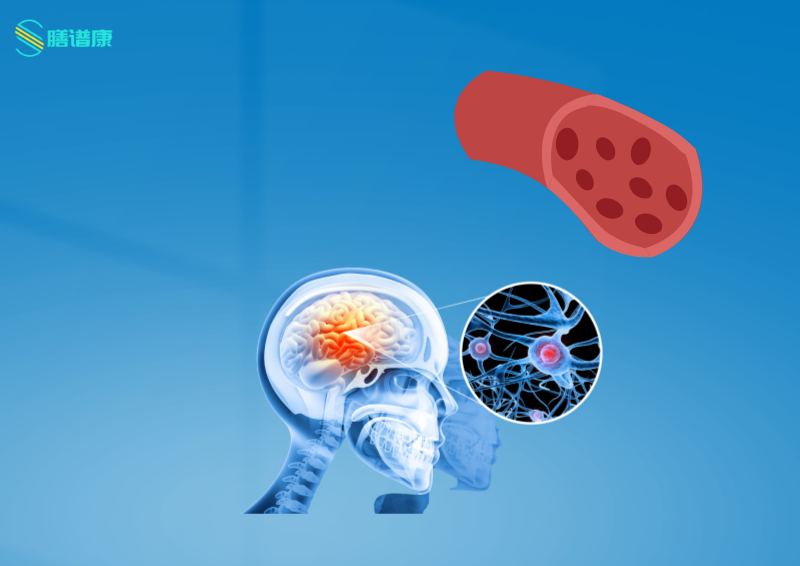Preventing Cerebral Infarction by Addressing Blood Stasis: Are You Prone to Blood Stasis Constitution? Key Characteristics for Quick Identification!