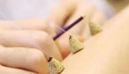 What Are the Classifications of Moxibustion?