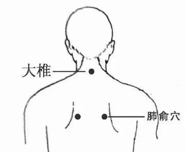 Luo Dalun: It is Incorrect to Classify Colds as Wind-Cold or Wind-Heat