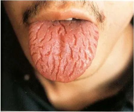 The Health Code Hidden on Your Tongue