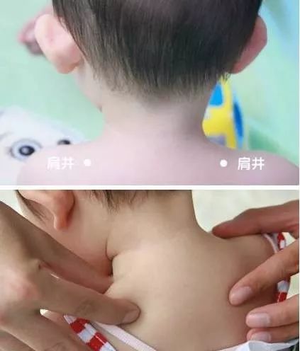 21 Pediatric Tuina Techniques to Easily Address Common Childhood Ailments!