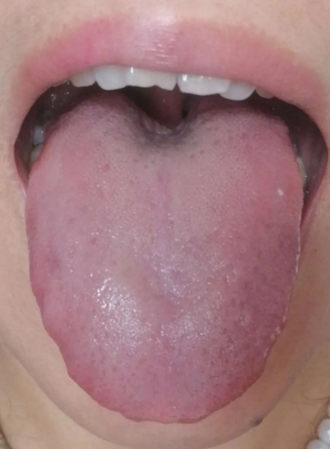 Inheritance of Traditional Chinese Medicine at Zhigu Tang | Basic Theory of TCM Lesson 34 (Tongue Diagnosis: Tongue Color)