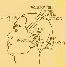 Understanding Electroacupuncture Therapy