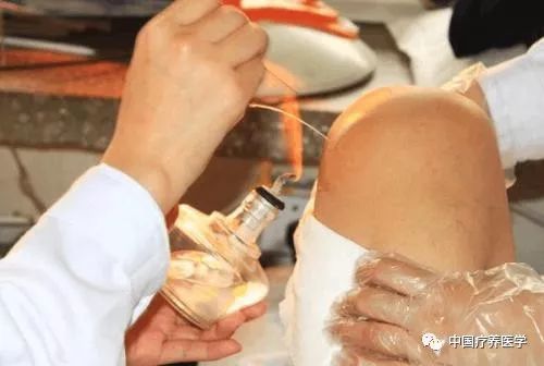 What Diseases Can Be Treated with Fire Needle and Needle Knife Therapy?
