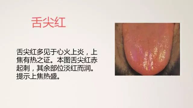 The Most Comprehensive TCM Tongue Diagnosis Atlas: Observe the Tongue, Understand the Whole Body!