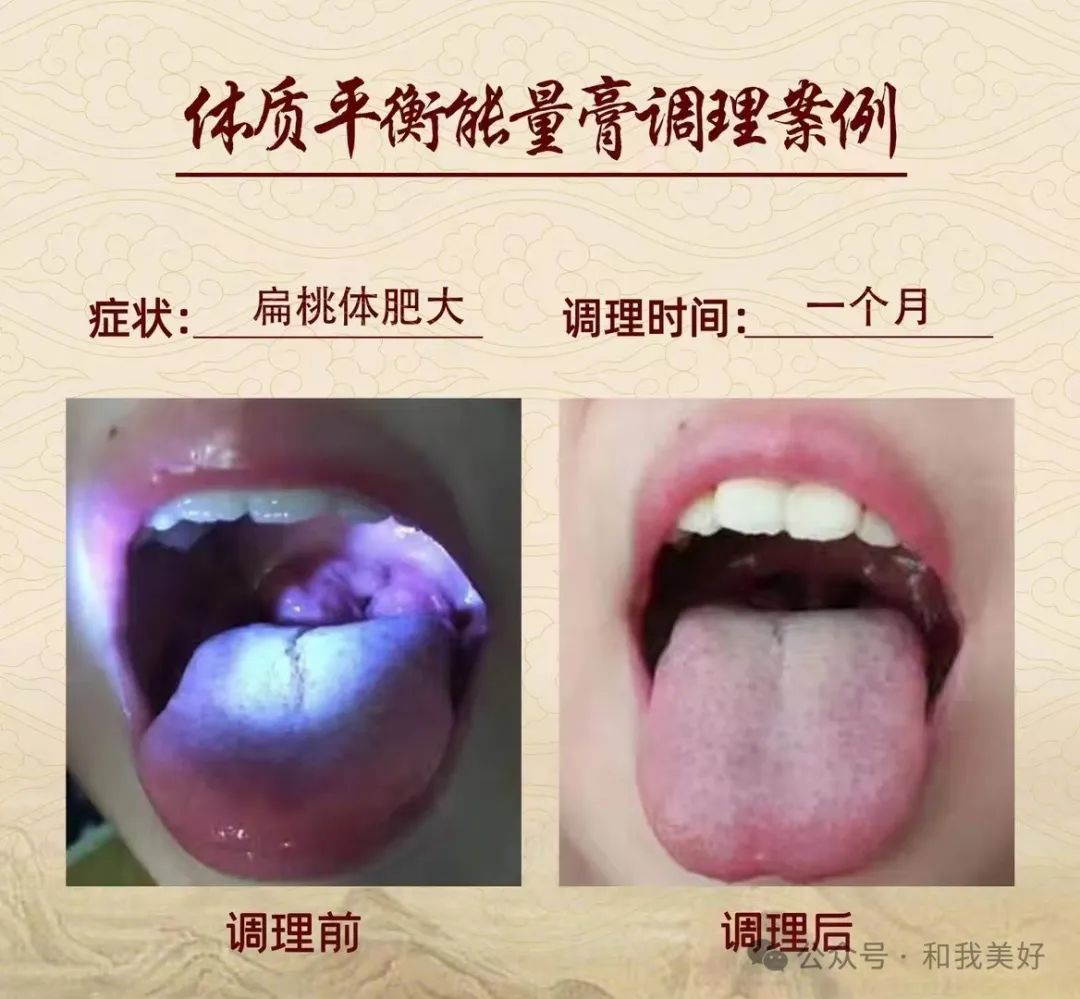 The Concept of Yin-Yang Balance in Traditional Chinese Medicine