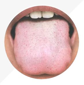 Analysis of High-Definition Tongue Diagnosis Charts: Understanding Health Through Your Tongue (Part 1)