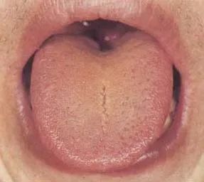 The Health Code Hidden on Your Tongue