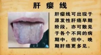 The Mastery of Traditional Chinese Medicine: Observation Diagnosis, Knowing by Observation is Divine!