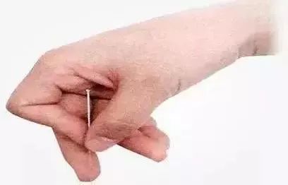 Comprehensive Guide to Acupuncture Techniques: A Must-Have for Beginners!