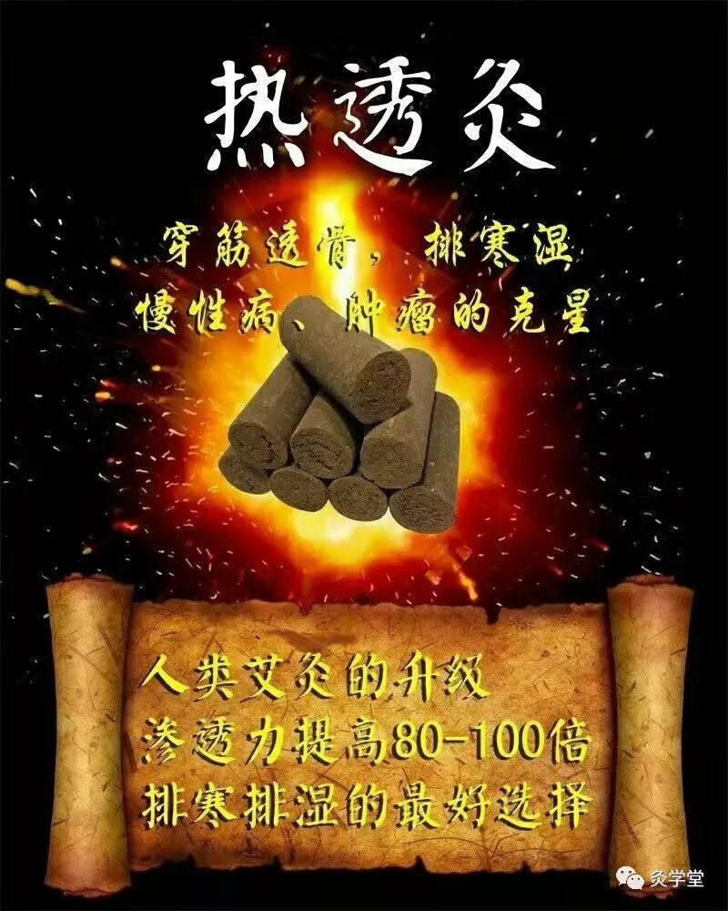 Moxibustion Therapy for Spleen and Stomach Yang Deficiency