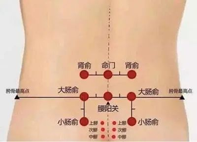 The Art of Cupping in Traditional Chinese Medicine: 5 Contraindications and Analysis of Cupping Marks