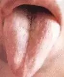 Comprehensive Guide to Tongue Diagnosis: Learn How Your Tongue Reflects Your Health!