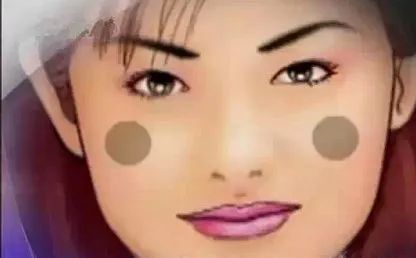 Comprehensive Guide to Facial Diagnosis in Traditional Chinese Medicine (With Images and Explanations)