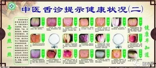 Understanding Tongue Diagnosis in Traditional Chinese Medicine (with Tongue Diagnosis Illustrations)