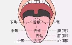 Understanding Tongue Coating in Traditional Chinese Medicine