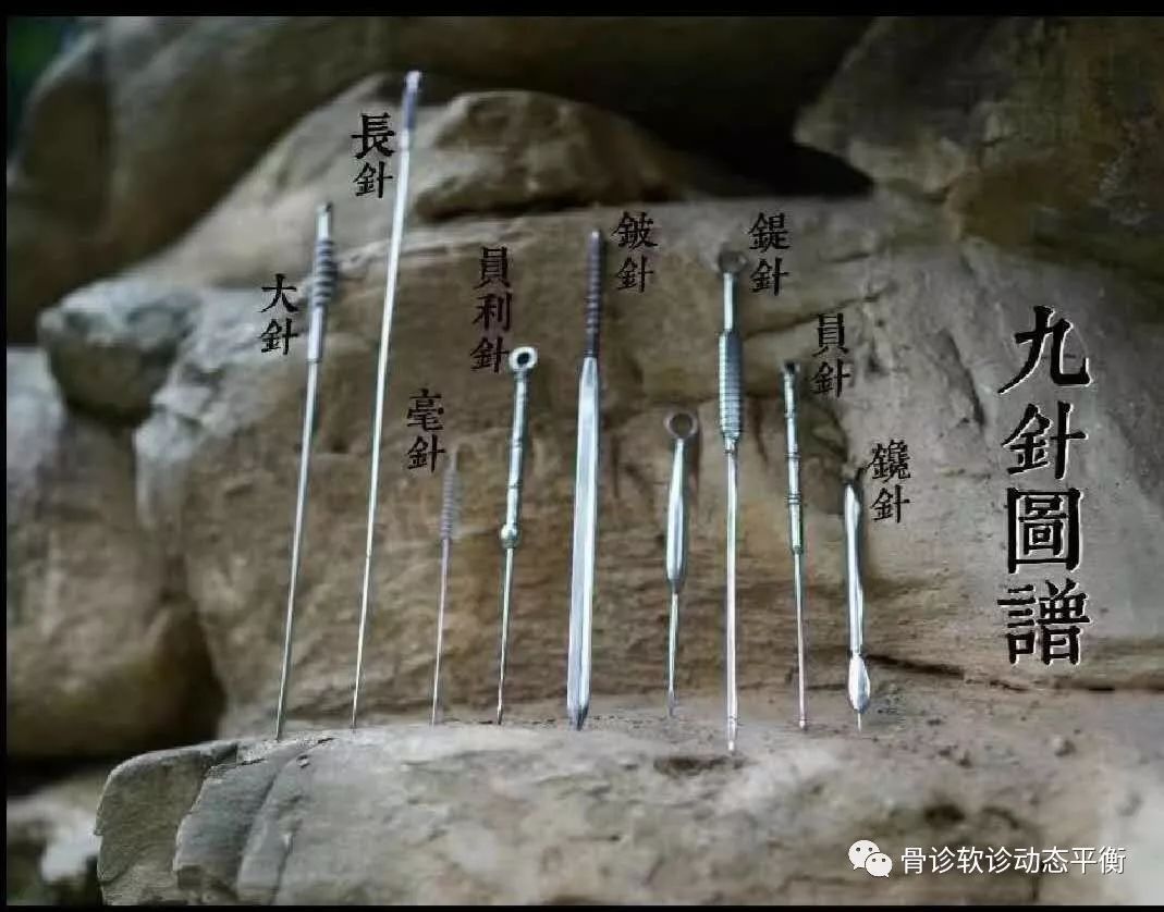 The Scope and Boundaries of the Efficacy of Fine Needling