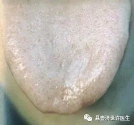 Understanding Qi Deficiency in Traditional Chinese Medicine