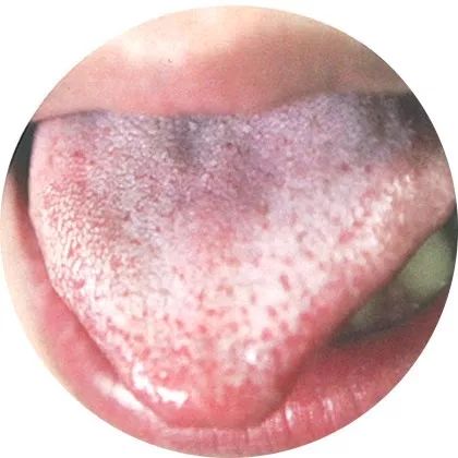 High-Definition Color Atlas of Tongue Diagnosis: Over 100 Types, The Most Comprehensive Ever! (Recommended for Collection)