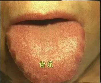 The Health Code Hidden on Your Tongue