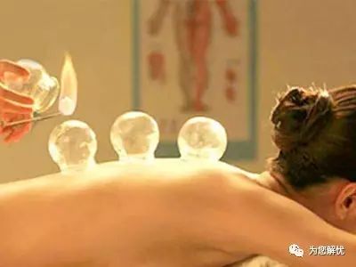 The Techniques and Diagnosis of Cupping Therapy in Traditional Chinese Medicine