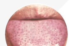 Analysis of High-Definition Tongue Diagnosis Charts: Understanding Health Through Your Tongue (Part 1)