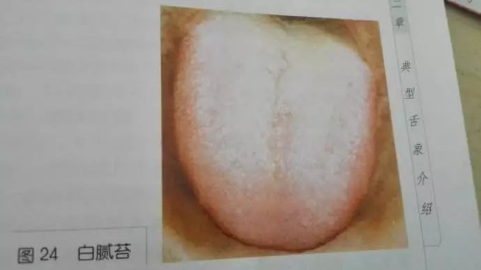 The TCM Tongue Diagnosis Atlas is Here! Observe the Tongue to Understand the Whole Body!