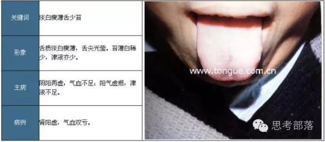 Comprehensive Guide to Tongue Diagnosis (8): 72 Types of Tongue Diagnosis Charts