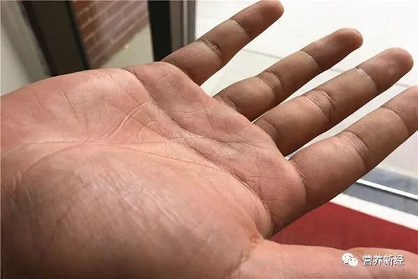 Understanding Yin Deficiency: Common Symptoms and Recommendations for Improvement