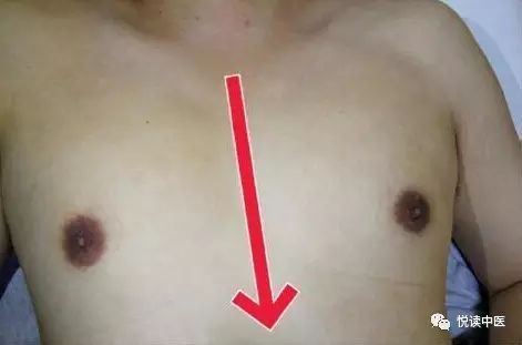 Understanding Gua Sha Techniques: Priceless Illustrations You Can't Miss!