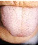 Comprehensive Guide to Tongue Diagnosis: Easily Understand Your Health Condition