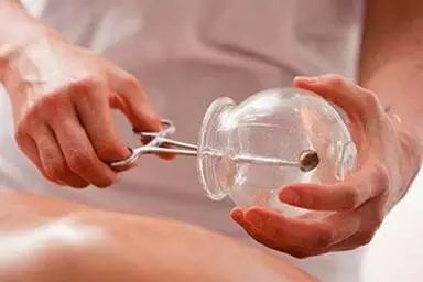 A Man Gets Stuck with a Cupping Jar at Home, Firefighters Help Cut It Off... Do You Really Understand Cupping?