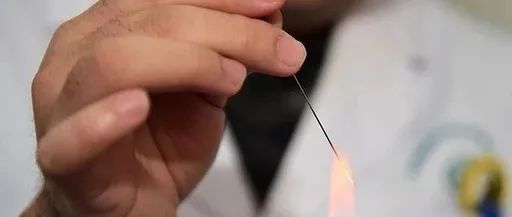 Dermatology: TCM Fire Needle Technique for Treating Skin Diseases