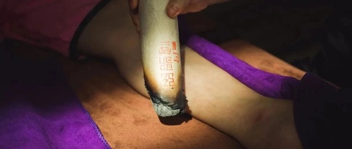 The Numerous Benefits of Moxibustion for the Calves