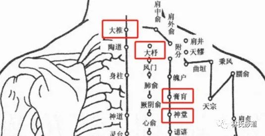 Key Points of Gua Sha
