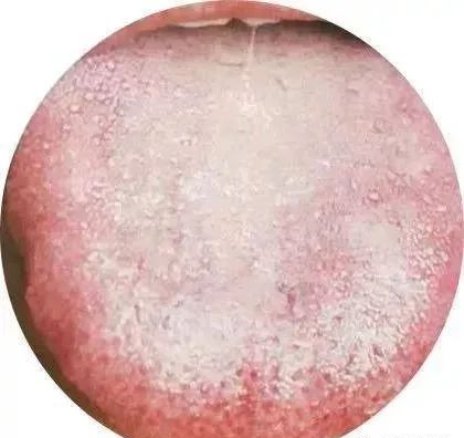 130 High-Definition Tongue Diagnosis Charts (Recommended for Collection)