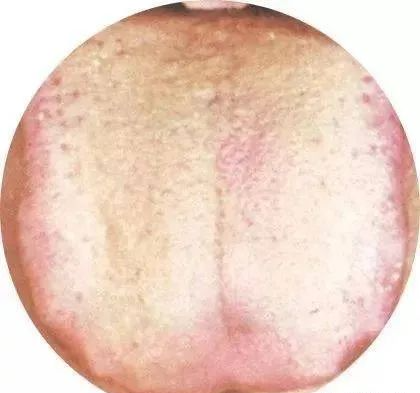 130 High-Definition Tongue Diagnosis Charts (Recommended for Collection)