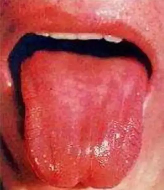 The Most Comprehensive Guide to Tongue Diagnosis! Master It and Become a Tongue Diagnosis Expert