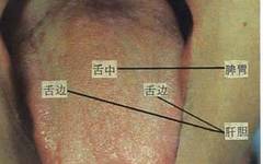 61 High-Definition Tongue Diagnosis Charts with Visual Comparisons