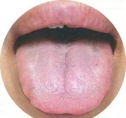 The TCM Tongue Diagnosis Atlas is Here! Observe the Tongue to Understand the Whole Body!