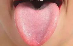 Traditional Chinese Medicine Tongue Diagnosis (Part Four) — Content of Tongue Diagnosis and Normal Tongue Appearance