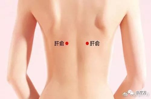 Comprehensive Guide to Cupping Therapy for the Back